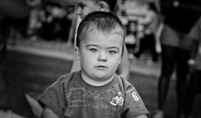 Psico Ayuda Infantil - Los niños con Síndrome de Down Psico Ayuda Infantil - Los niños con Síndrome de Down